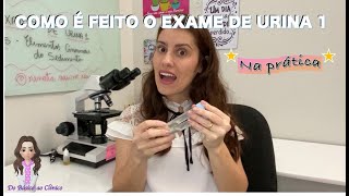 COMO É FEITO O EXAME DE URINA 1 Na prática [upl. by Eiten]