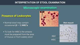 Interpretation of Stool Examination [upl. by Lucie]