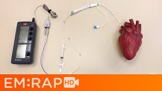 Placing a Transvenous Pacemaker [upl. by Jezabel262]