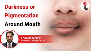 Oral Candidiasis Oral Thrush  Causes Pathophysiology Signs amp Symptoms Diagnosis Treatment [upl. by Moina]