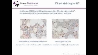 Immunohistochemistry Webinar An Introduction to Immunohistochemistry [upl. by Bock]