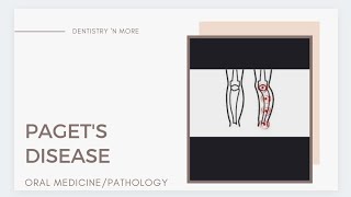 PAGETS DISEASE [upl. by Amaj]