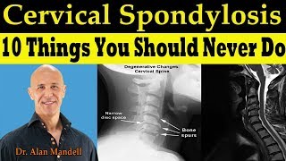 Spinal Trauma Cervical Trauma Protocol Common Spinal Fractures – Radiology  Lecturio [upl. by Eniamirt88]