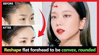 How to Reshape flat forehead to be convex rounded  Fix flat face to the oval face naturally [upl. by Moriyama]