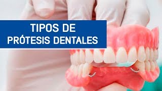 Tipos de prótesis dentales  Odontoespecialistas [upl. by Nunci]