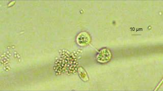 amoeba dividing prob Cochliopodium [upl. by Whittaker]