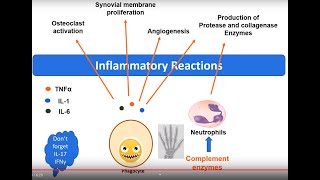 Rheumatoid Arthritis pathology in 5 minutes [upl. by Soigroeg]