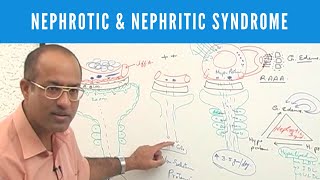 Nephrotic and Nephritic Syndrome  Causes Symptoms amp Treatment🩺 [upl. by Llednav]