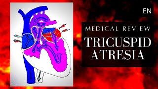 Tricuspid Atresia Anatomy Pathology and Treatment [upl. by Stormie568]