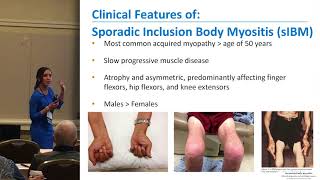 Myositis  Introduction  Neurology Medicine Lectures  VLearning  sqadiacom [upl. by Netloc982]