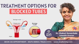 Treatment options for blocked fallopian tubes  Dr Chekuri Suvarchala [upl. by Center]