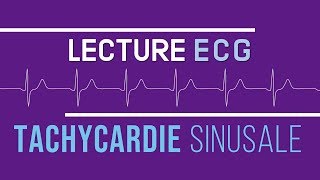 Interprétation ECG  Tachycardie Sinusale [upl. by Bonneau667]