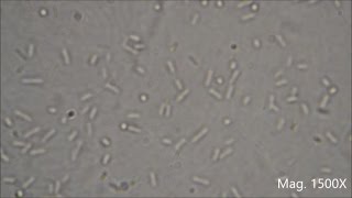 Bacteria under the Microscope E coli and S aureus [upl. by Susej887]