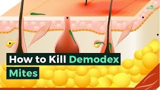 How to Kill Demodex Mites [upl. by Iago399]