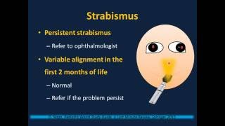 Newborn Examination Neonatology II [upl. by Evy521]