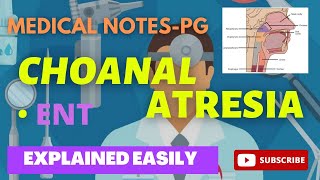 CHOANAL ATRESIA  MEDICAL NOTES PG [upl. by Creedon]