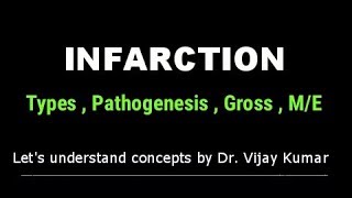 Infarction Pathology  Infarction Types  Infarction Morphology  Pathology Lectures [upl. by Omlesna]