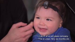 Born with Microtia and Atresia [upl. by Trinia]