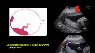 Anatomy of the Perineum 3D tutorial  UKMLA  CPSA  PLAB 2 [upl. by Gagne]