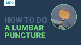 How to do a lumbar puncture [upl. by Reisfield]