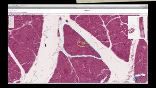 Histology Helper  Muscle Histology [upl. by Irbua]