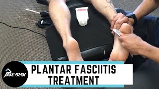 Plantar Plate InternalBrace™ Ligament Augmentation Surgical Technique [upl. by Piotr]