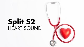 Fixed Split S2  Heart Sounds  MEDZCOOL [upl. by Haizek]