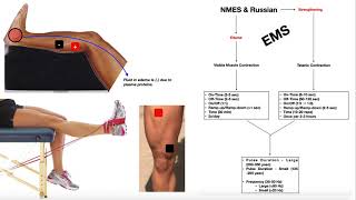 EMS 7500 Muscle Stimulator  ElectroMuscle Stim Review [upl. by Romina]