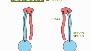 Reflejos pupilares  Oftalmología [upl. by Shiau]