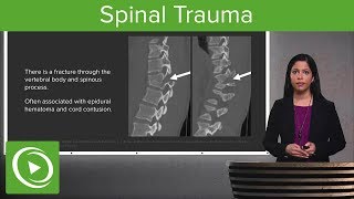 Passive Accessory Intervertebral Mobilization PAIVM of the cervical spine Physical Therapy [upl. by Eillen153]