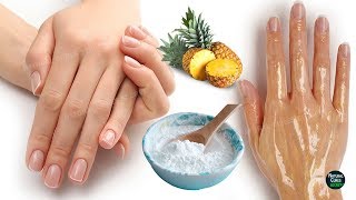 How To Remove Wrinkles From Hands Naturally in 2 Days [upl. by Larok]