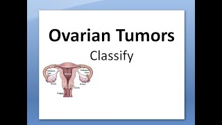 Digital Surgical Pathology 38 Endometrial Stromal Sarcoma [upl. by Refeinnej]