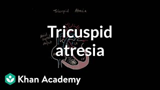 Tricuspid atresia  Circulatory System and Disease  NCLEXRN  Khan Academy [upl. by Lsiel]