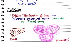 Cirrhosis of Liver  Pathology [upl. by Belanger]