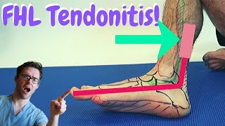 Flexor Hallucis Longus PAIN FHL Tendonitis BEST Treatment [upl. by Brigitte]