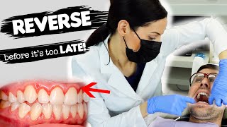 How To Treat Gum Disease [upl. by Euqinna]