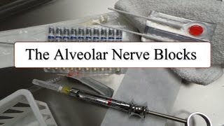 The Alveolar Nerve Blocks [upl. by Inah]