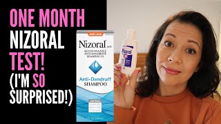 Top 3 Ketoconazole Shampoos for Hair Growth Nizoral vs Ultrax Labs Hair Surge vs Revita [upl. by Mcloughlin280]