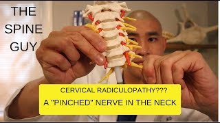 Cervical Spondylosis Stretches amp Exercises  Ask Doctor Jo [upl. by Carlye]