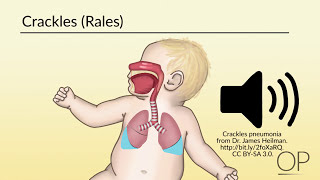 Airway Devices 01 Direct Laryngoscopy [upl. by Meggi39]