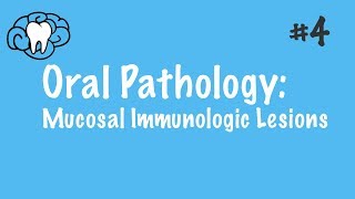 Oral Pathology  Mucosal Immunologic Diseases  INBDE ADAT [upl. by Hamish]