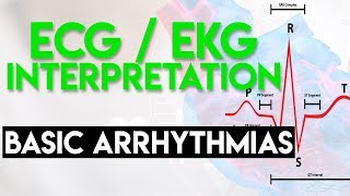 Basic Arrhythmias  Sinus Brady Tachy Premature Beats  ECG EKG Interpretation Part 3 [upl. by Rhiana]