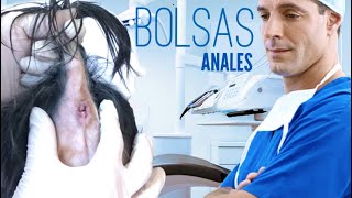 Limpieza de bolsas anales en perros [upl. by Doak]