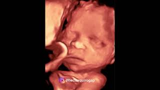 4D ultrasound at 27 weeks of pregnancy [upl. by Ocsecnarf]