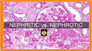 Nephritic vs Nephrotic Syndromes [upl. by Weaks]