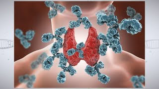 Understanding Autoimmune Thyroid Disease [upl. by Cleon]