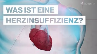 Herzinsuffizienz Ursachen und Symptome [upl. by Etteniotna]