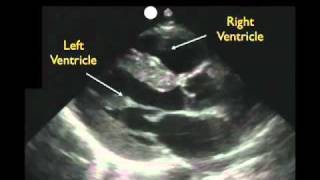 Epididymal Cyst Hydrocele and Varicocele cured in 25 days  Dr Health [upl. by Murdocca]