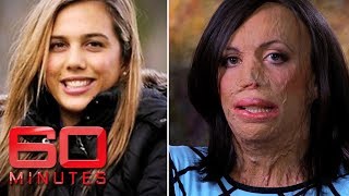 Turia Pitt was burned alive during an ultramarathon  60 Minutes Australia [upl. by Marquez]