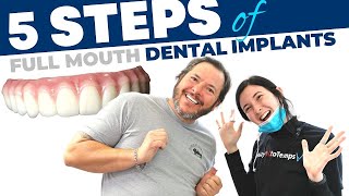 Full Mouth Dental Implant Procedure StepbyStep [upl. by Acireit]